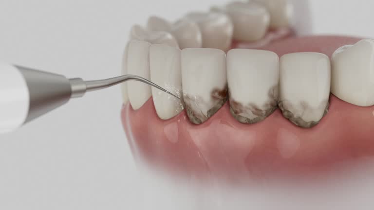 Trusted Dental Implants service in Hilliard, FL - Dentist Open Now